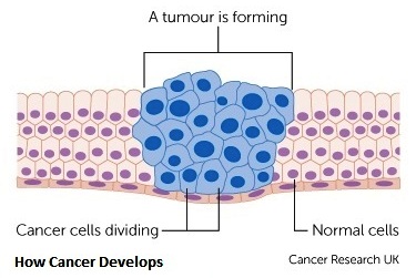 1-how-cancer-develops