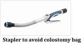 q-29-3-stapler-to-avoid-colostomy-bag