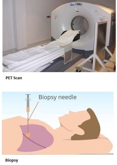 4a-pet-scan