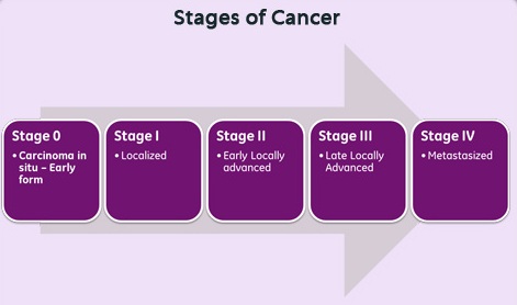 5-cancer-staging